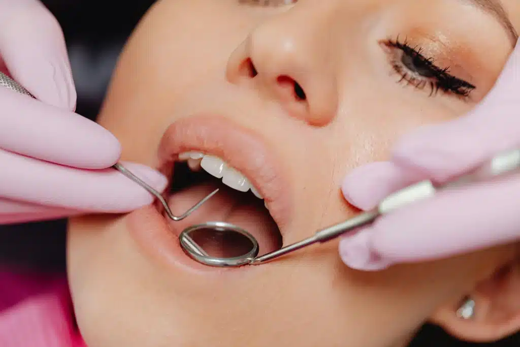 Oral Cancer Screening