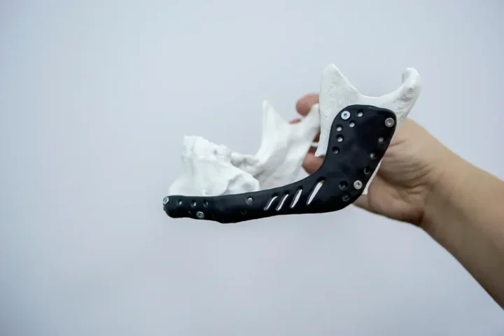 service-maxillofacial-prosthetics Service maxillofacial prosthetics