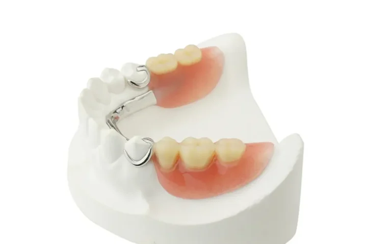 Service tpartial dentures